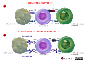 Illustration du blocage par le Tislezumab de la liaison de PD-1 aux ligands PD-L1 et PD-L2 qui permet la r&eacute;activation de la r&eacute;ponse antitumorale du LcT.